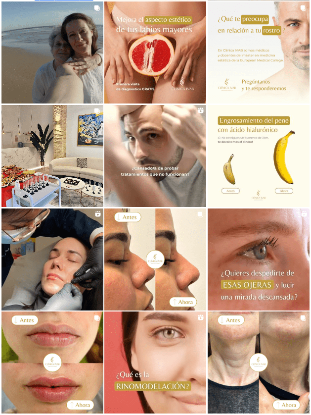 Instagram clínica estética IVAB